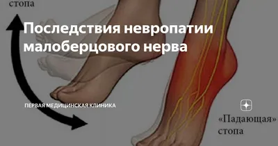 Лошадиная стопа и человек: Изображения в JPG, PNG, WebP