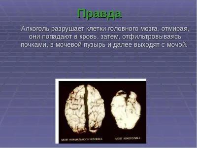 Мозговые структуры в сравнении: алкоголь и здоровье в фотографиях