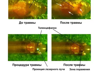 Мозг рыбы: потрясающая картина, захватывающая воображение