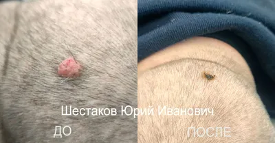 Наросты на голове: Фотография высокого качества WebP