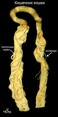 Фотка нематод в человеческом теле: загрузите картину в формате PNG
