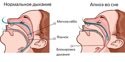 Нёбо здорового человека в JPG: Отличное качество изображения