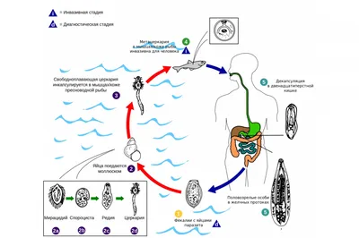 Описторхоз у Человека: Эксклюзивные Изображения с Опцией Загрузки