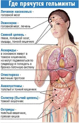 Галерея Фотографий Описторхоза: JPG, PNG, WebP в наличии