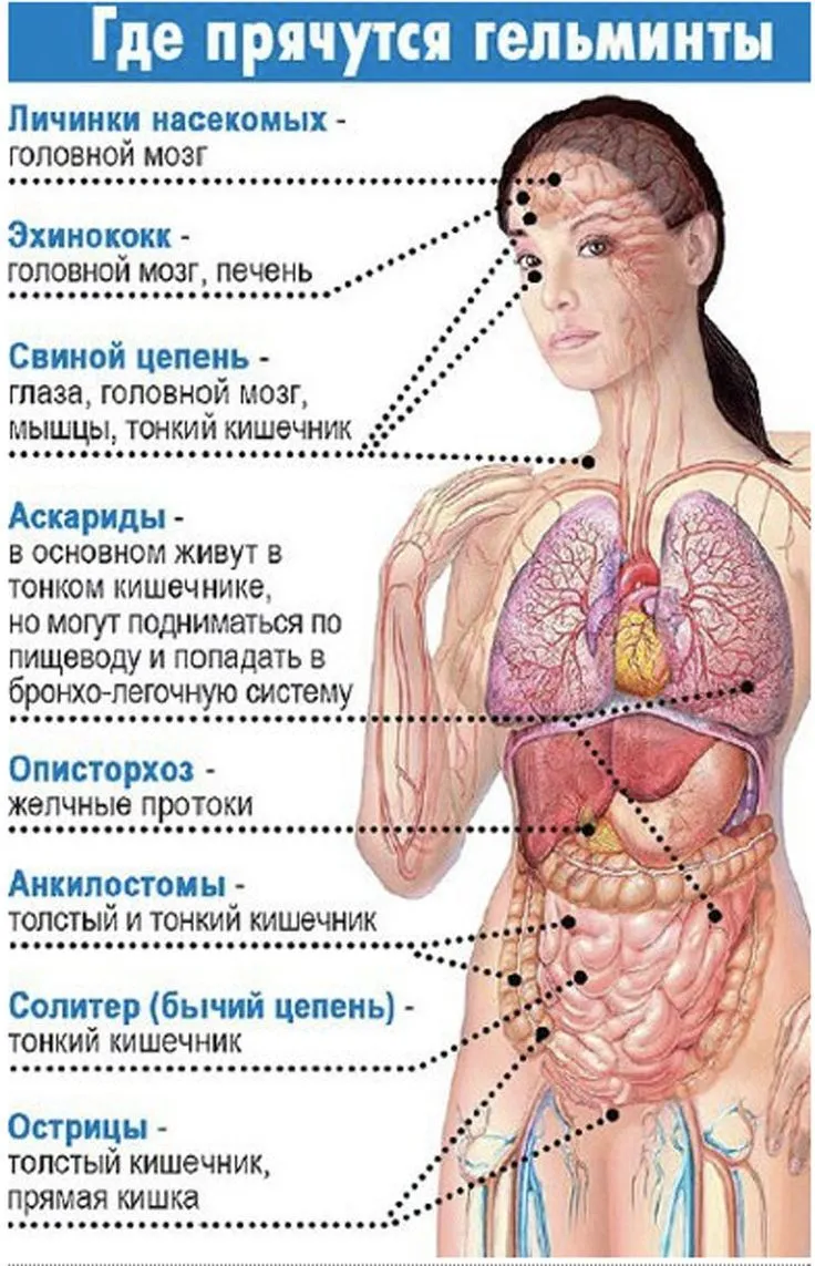 Описторхоз у человека (38 фото)