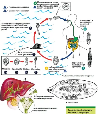 Фотографии Описторхоза: Выберите Размер и Скачайте Фото