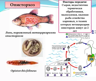 Картинка описторхоза в рыбе: выберите размер изображения