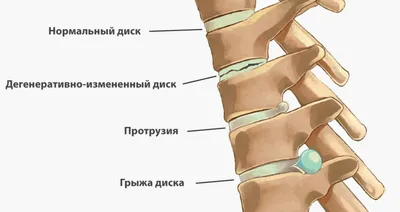 Анатомия человека: JPG изображение позвоночника