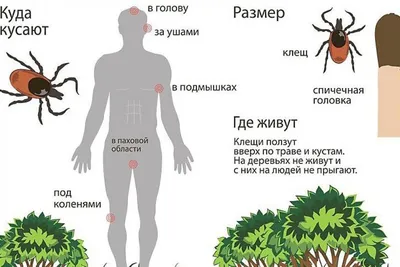 28. Избранные изображения: Паразиты на голове в разных вариантах