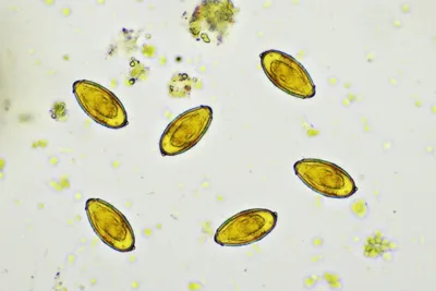Эксклюзивные снимки паразитов в кале человека: Скачивайте в любом формате