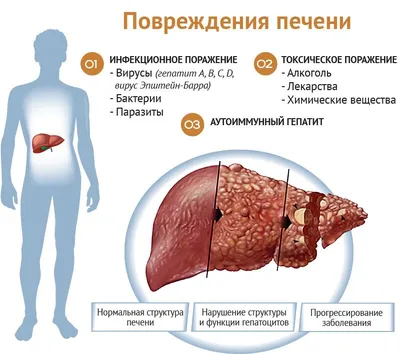 Паразиты в печени человека: Фото и подробности