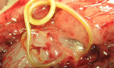 Исследование внутреннего мира: Фото паразитов в человеческом теле