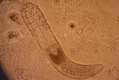 Исследование микромира: Фото паразитов в различных форматах