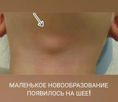 11. Изображения подкожных червей: Свобода выбора формата – JPG, PNG, WebP