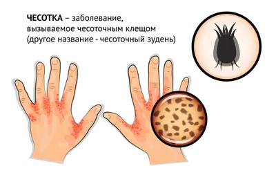 23. Фото подкожных червей: Откройте для себя красоту внутреннего мира