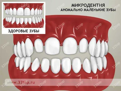 Фотка с полиодонтией: скачайте изображение в JPG, PNG, WebP