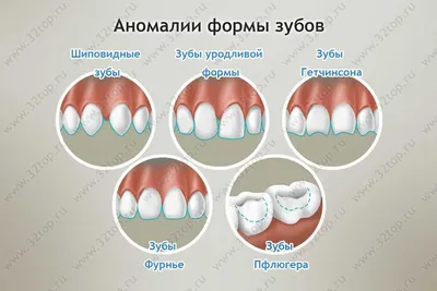 Изображение человека с полиодонтией: скачивание в JPG, PNG, WebP