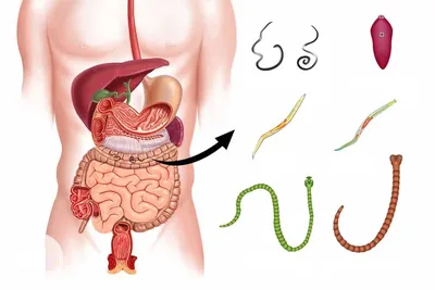Глисты у человека: Фотографии с возможностью выбора формата