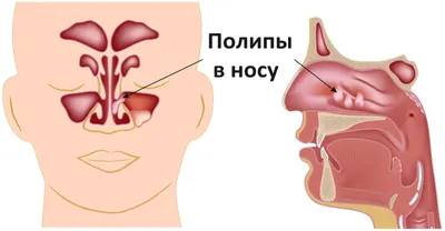 Исследование глистов у человека: Размеры изображений