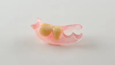Фотка протеза бабочки на зубах - небольшой размер JPG
