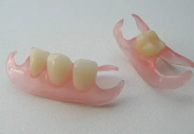 Картинка протеза бабочки на зубах - выбор размера: небольшой