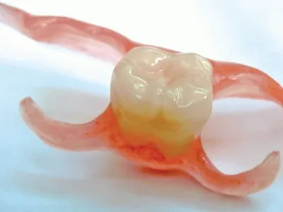 Изображение протеза бабочки на зубах в формате WebP