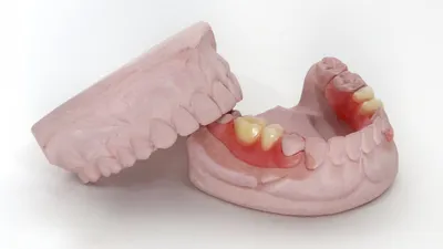 Фотка протеза бабочки на зубах с возможностью выбора размера