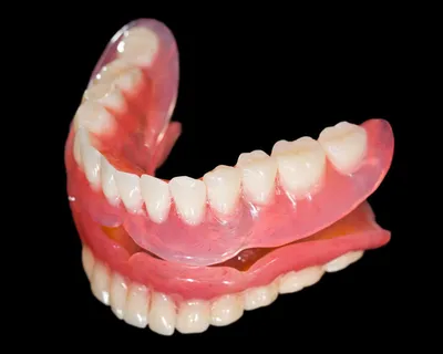 Картинка протеза бабочки на зубах - небольшой размер JPG, WebP