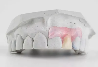 Изображение протеза бабочки на зубах - небольшой размер PNG