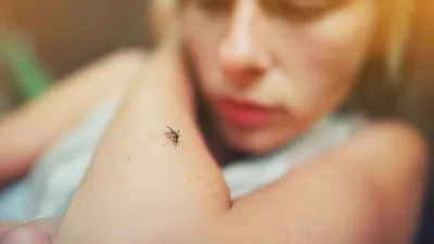 Интересные фото расчесок от укусов комаров: выберите свою идеальную