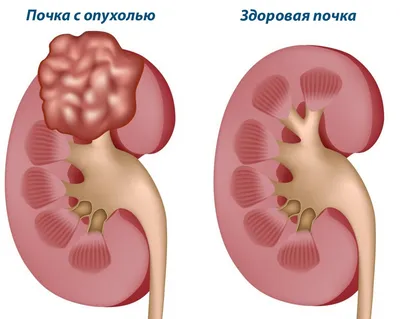 Почки в деталях: соберите свой уникальный комплект изображений