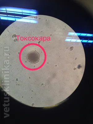 Фотографии различных видов глистов с подробными описаниями