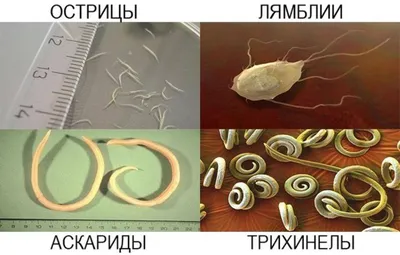 Изображения разных видов глистов в человеческом теле