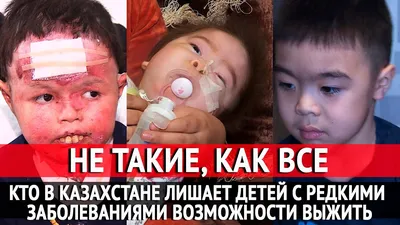 Редкие болезни человека в фотографиях: Загадочные картины