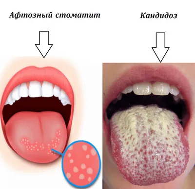 37. Фото на выбор: форматы JPG, PNG, WebP для скачивания