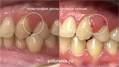 Выберите размер: Персонализируйте изображения ртов человека