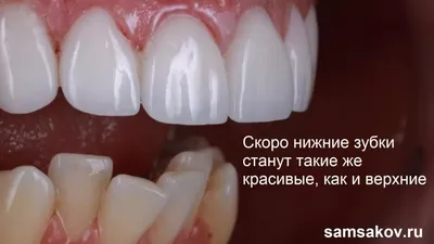 Картинка с красивыми зубами в WebP формате