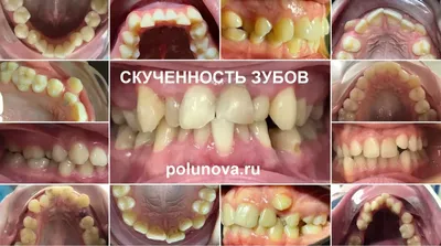 Изображение зубов с элегантной формой