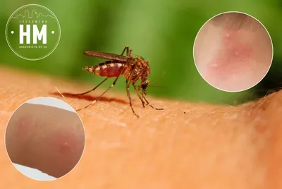 Взгляните на красоту самки малярийного комара на фото