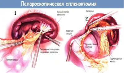 Фото человеческой селезенки: Ваш выбор размера и формата