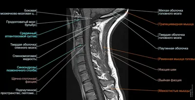 Изображение анатомии шейного отдела позвоночника в HD