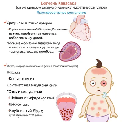 Притягательные изображения бабочек синдрома бабочки