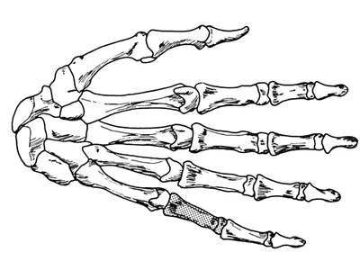 Изображение скелета руки: Персонализируйте размер и выберите формат (JPG, PNG, WebP)