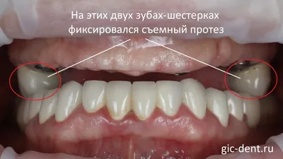 Молочные зубы vs. Постоянные зубы: фотографии с высоким разрешением