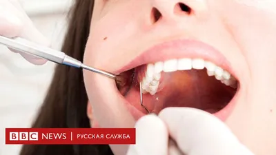 Фотогалерея зубов человека: выбор размера и формата