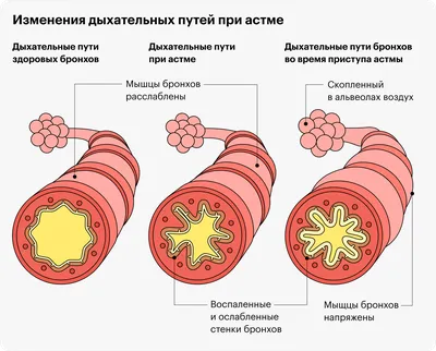 Картинка смертельных точек: Фото в формате WebP