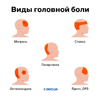 1) Смешные картинки болит голова: выберите размер изображения и скачайте в форматах JPG, PNG, WebP