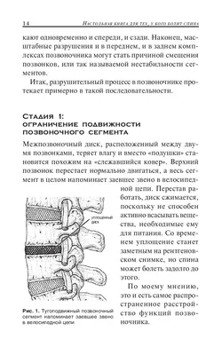 **Фото смешные картинки болит спина - скачать в WebP формате**.