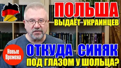 Улыбнитесь смешным фото синяка под глазом!