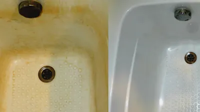 Фото содовых ванн до и после